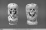 Rosary bead, 2 faces (chapelet) (Side 2)